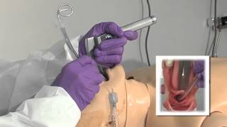 9 Orotracheal Intubation [upl. by Aliam]