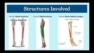 Shin Splints Injury Analysis [upl. by Barden]