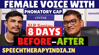 Transforming Female Voice With Phonatory Gap in Just 8 Days  AIIMS Delhi Alumnus slpsanjaykumar [upl. by Atin]