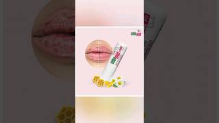 Sebamed lip Defence  Best lips balm for Men amp Women dermatology skincare lips 1mgofficial [upl. by Innavoeg]