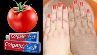 Most Easy Hand Cleaning Tips  How To Get Fair Hand  Remove Hand Tan [upl. by Bittner]