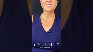 EVE Lift™ Weekly RecapNovember 24th  Eden Plastic Surgery Dr Ali Charafeddine MD [upl. by Thirza317]