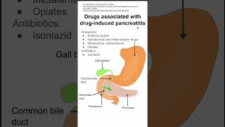 Drugs associated with druginduced pancreatitis [upl. by Gnehc]