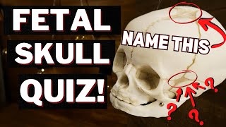 Practice Quiz on Fetal Skull Structures so you Pass Your Exam [upl. by Jamnis614]