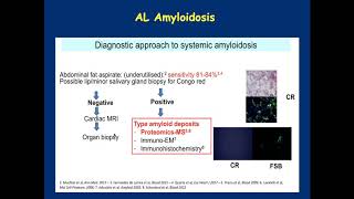 Light Chain AL Amyloidosis Diagnosis and Treatment [upl. by Vere]