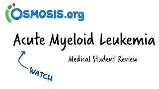 Acute Myeloid Leukemia  Clinical Presentation [upl. by Suiramed21]