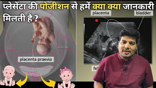 placenta posterior means boy or girl  anterior placenta baby gender  ultrasound se jane ladka [upl. by Georgine]