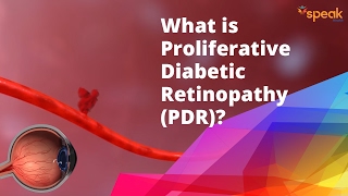 What is Proliferative Diabetic Retinopathy PDR [upl. by Ardnoek]