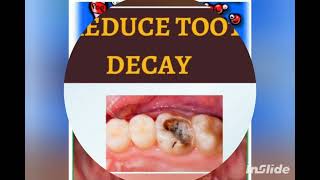 toothache home remedies [upl. by Clayton918]