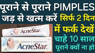 Agar face par pimples ho to kya karna chahiye  Pimples kaise hataye  pimples hatane ka tarika [upl. by Anidem]