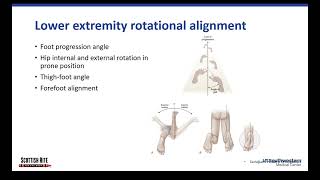 Lower Extremity Alignment [upl. by Sokil]