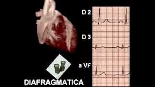 Electrocardiograma Básico [upl. by Muhcan]