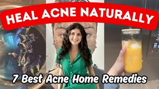 Top 6 HOME REMEDIES FOR ACNE SCARS amp PIMPLES Oily Dry amp Sensitive Skin [upl. by Anaid]