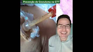 Prevenção de granuloma na gastrostomia gtt granuloma Gastrostomia cuidador linknabio [upl. by Arammahs]