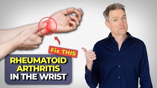 Rheumatoid Arthritis In The Wrist  How To Fix It [upl. by Acirahs]