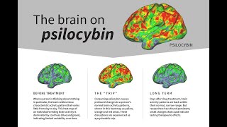 Psilocybin desynchronizes the human brain [upl. by Danielson323]