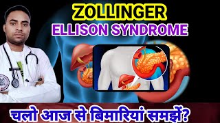 Whats Zollinger Ellison Syndrome ZES DISEASE  SYMPTOMS OF ZES  DISEASES [upl. by Aneetsirhc]