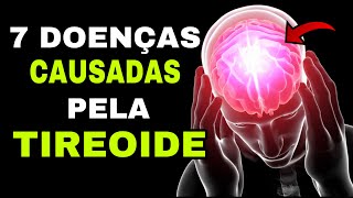 7 DOENÇAS CAUSADAS PELA TIREOIDE Hipotireoidismo e Hipertireoidismo [upl. by Nemad529]