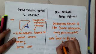 non cirrhotic portal hypertension  Hepatobiliary System [upl. by Lsiel282]