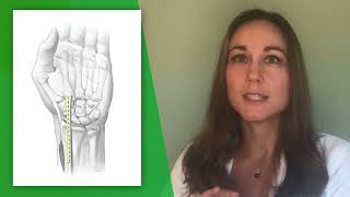 Top 3 Things Patients Wish they Knew Before Thumb Arthritis Surgery by Debra Anne Bourne MD [upl. by Yesac]