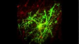 Myelination in Action [upl. by Zuleika]