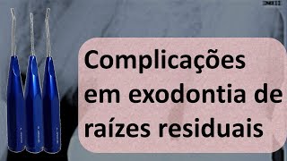 Complicações em exodontias de raízes residuais  Odontologia  Dra Bianca Rosa [upl. by Ahseiat]