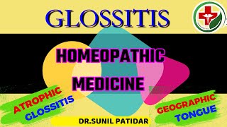 Glossitis tongue treatment  Glossitis homeopathic treatment  Glossitis homeopathic medicine [upl. by Naeruat]