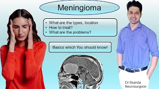 Meningioma Symptoms Treatment Most common benign brain tumor Things U should know By Dr Skanda [upl. by Nobel]