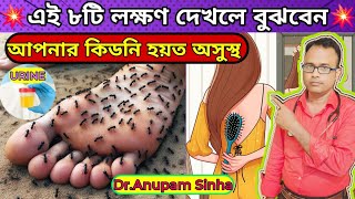 💥এই ৮টি লক্ষণ দেখলেই বুঝবেন আপনার কিডনি খারাপ হতে শুরু হয়েছে। Early Signs Of Kidney Disease [upl. by Lrat]