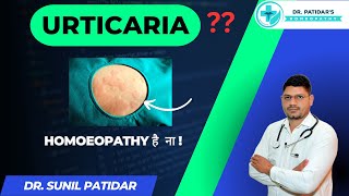 quotRelief from Urticaria Homeopathic Medicine by Dr Sunil Patidarquot [upl. by Arikal]