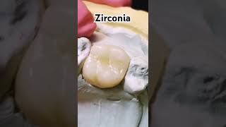 shorts Zirconia Dental [upl. by Adnamma]