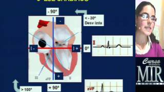 Cómo interpretar un ECG repaso [upl. by Pfister]