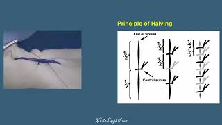 6 4 Principle of Halving Essential Surgical Skills WhiteKnightLove [upl. by Ahseret870]