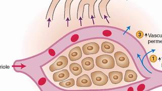 Mechanisms of edema development [upl. by Karlotta]