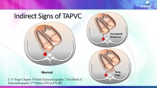 Fetal Echo for adult cardiologists part 1 [upl. by Sitoel816]