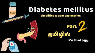 Diabetes Mellitus Part 2 Clinical  pathogenesis  Complications  Diagnosis  Treatment in Tamil [upl. by Derinna856]