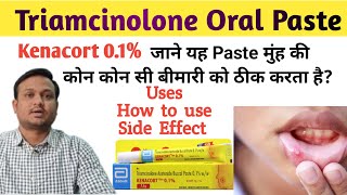 Kenacort 01  Kenacort gel how to use  Triamcinolone oromucosal paste bp 01 ww in hindi [upl. by Ianteen528]