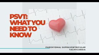 Know about PSVT  Paroxysmal Supraventricular Tachycardia [upl. by Spooner]