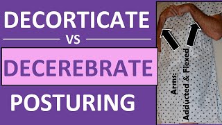 Decerebrate vs Decorticate Posturing Rigidity Mnemonic amp Pictures Nursing NCLEX [upl. by Naejeillib]