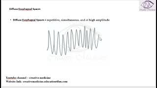 Lec 1 Diffuse Esophageal Spasm mp4 [upl. by Ahtilat]