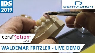 ceraMotion® LiSi auf der IDS 2019 FrontzahnVeneers [upl. by Parsons]