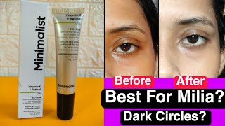 Minimalist 1 Retinol Under Eye Cream Review  BEST Retinol Under Eye Cream✅For MiliaDark circles [upl. by Aibar30]