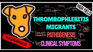 Thrombophlebitis migrants Trousseau syndrome Pathogenesis Symptoms Treatment [upl. by Mellicent]