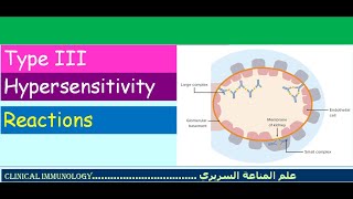 Lecture 6  Type III Hypersensitivity [upl. by Swanhilda576]