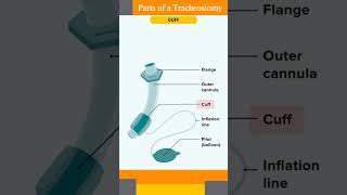 tracheostomy tube l tracheostomy tube parts shorts behere anatomy [upl. by Ebanreb]