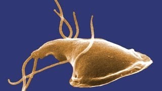 Giardia What You Should Know [upl. by Yrod]