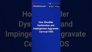 Serviceconnected shoulder impingement can cause cervical IVDS veteranassistance military viral [upl. by Kreiker]