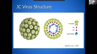 Progressive Multifocal Leukoencephalopathy in Monoclonal Antibodies Era  Joe Berger  5 April 2020 [upl. by Gris]