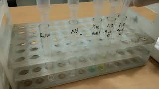 Adsorption inhibition test saliva test for secretory status [upl. by Haniraz]