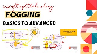 WHAT IS FOGGING TEST  WHY  WHEN AND HOW TO FOG  OPTICS AND REFRACTION SERIES [upl. by Ros]